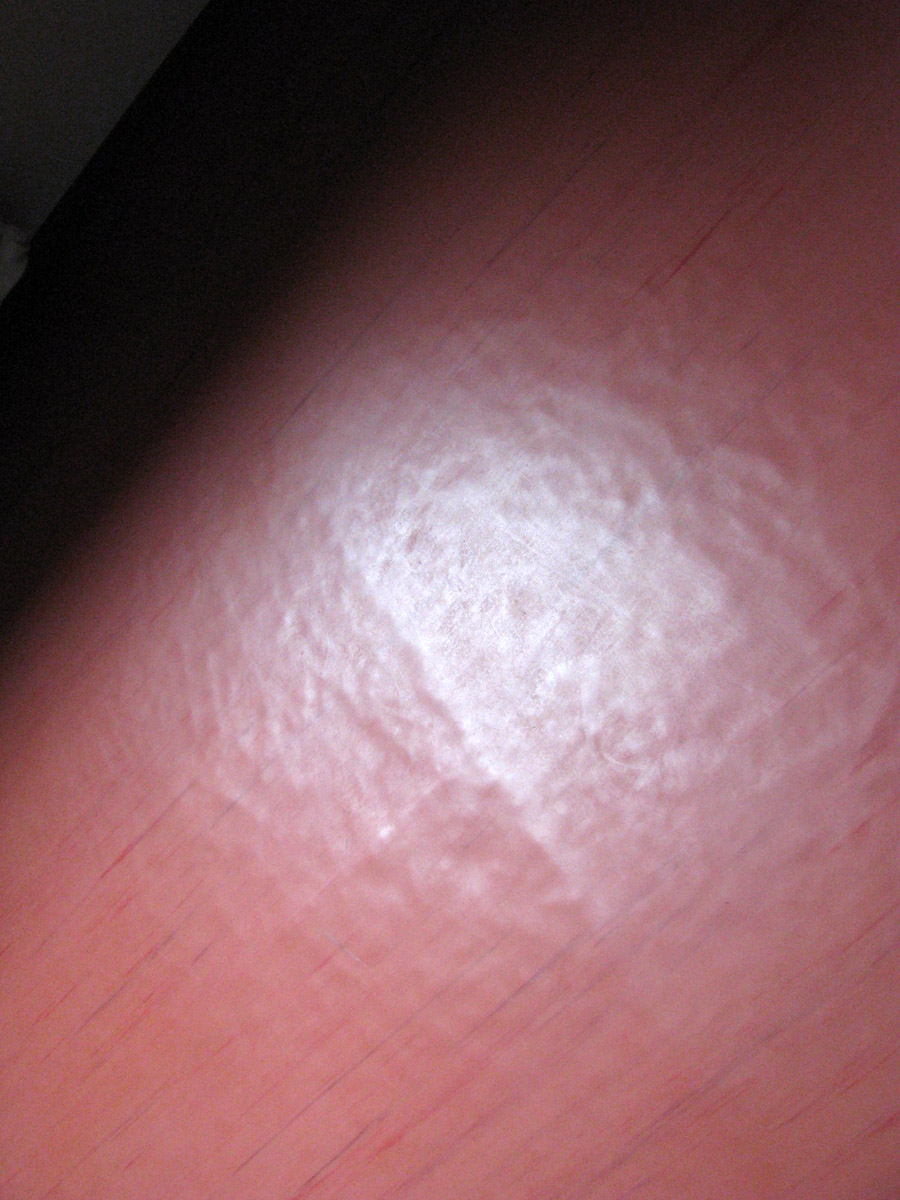 Obr. 3: Mnohačetné puchýře na podlahovině z PVC