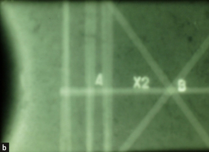 Obr. 2: Část výkresu projektovaného vyztužení vazníku v okolí otvoru s radiogramem v místě pořízeným (a) a detail radiogramu, kde je zjevná absence kruhové výztuže s radiálními pruty (b)  