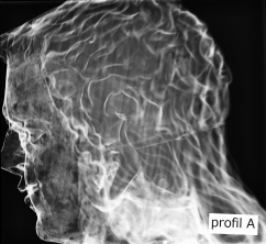 Obr. 4: RTG diagnostika spojení jednotlivých částí dřevěné sochy sv. Jiří s kopím