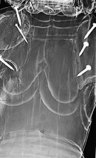 Obr. 4: RTG diagnostika spojení jednotlivých částí dřevěné sochy sv. Jiří s kopím