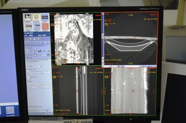 Obr. 7: CT přístroj a prostředí programu pro vyhodnocení snímku