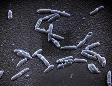 Legionella pneumophila je parazit, který vniká do lidských buněk a způsobuje tzv. legionářskou nemoc. Ta má podobný průběh jako zápal plic. Pro lidi s oslabenou imunitou představuje životu nebezpečné onemocnění.