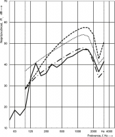 Obr. 5: Vliv doporučených úprav z obr. 4 na neprůzvučnost